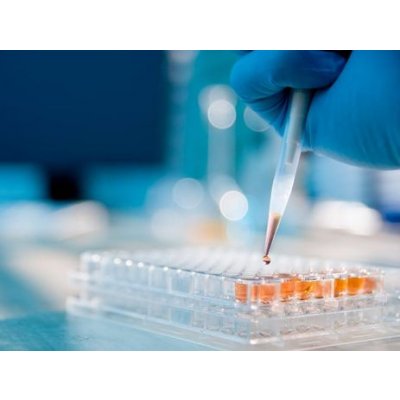 Can Modulation of the Microbiome Improve Cancer Immunotherapy Tolerance and Efficacy?