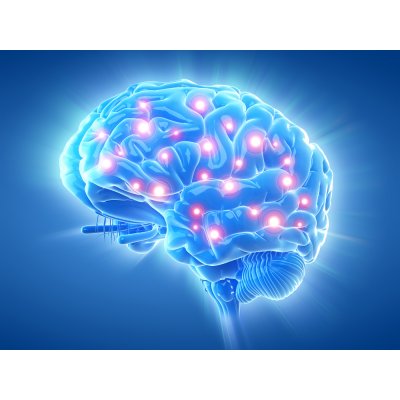 Brain Scans After Memory Shifts May Show Alzheimer's Risk